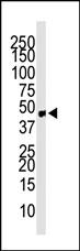 Western blot analysis of anti-CCBP2 Pab (Cat. #AP2012b) in mouse small intestine tissue lysate. CCBP2 (Arrow) was detected using purified Pab. Secondary HRP-anti-rabbit was used for signal visualization with chemiluminescence.