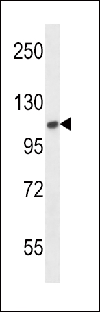 WB - FGFR2 Antibody (N-term) AP7637a