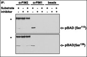 PIM proteins were immunoprecipitated from MV4;11 cells and the agarose-protein A-immunoprecipitate complex was tested for its ability to phosphorylate BAD in vitro in the presence or absence of K00135. Phosphorylation of BAD (both on Ser112 and Ser136, detected by WB with phospho-specific antibodies) was abrogated on addition of the compound. Asterisks, strong bands corresponding to the heavy chain of the anti-PIM2 rabbit antibody recognized by the antirabbit immunoglobulin G secondary antibody. Beads alone (without anti-PIM antibodies) were incubated with the MV4;11 extract and used for the same in vitro phosphorylation reaction as a negative control.