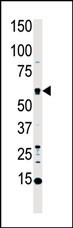 Western blot analysis of anti-MST1 Pab (Cat. #AP7922a) in HL60 cell lysate. MST1 (arrow) was detected using purified Pab. Secondary HRP-anti-rabbit was used for signal visualization with chemiluminescence.