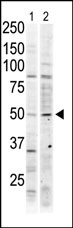 The anti-MST2 Pab (Cat. #AP7923a) is used in Western blot to detect MST2 in Jurkat cell lysate (lane 1) and mouse ovary tissue lysate (lane 2).