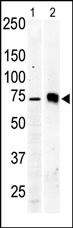 The anti-PKC beta2 Pab (Cat. #AP7016b) is used in Western blot to detect PKC beta2 in Jurkat cell lysate (lane 1) and mouse brain tissue lysate (lane 2).