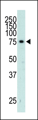 The anti-GRK3 Pab (Cat. #AP7005a) is used in Western blot to detect GRK3 in  mouse heart tissue lysate.