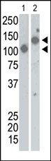 The anti-SARS-Sn Pab (Cat. #AP6000a) is used in Western blot to detect recombinant Spike proteins, aa17-537 (Lane 1) and aa17-756 (Lane 2).