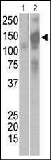 The anti-SARS-Sm Pab (Cat. #AP6000b) is used in Western blot to detect recombinant Spike proteins, aa17-537 (Lane 1) and aa17-756 (Lane 2).