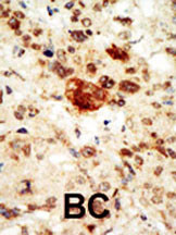 IHC-P - EphA1 Antibody (C-term) AP7606b
