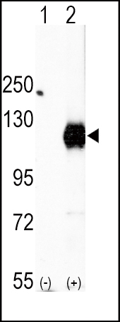 Western blot analysis of EphA2 (arrow) using rabbit polyclonal EphA2 Antibody (C-term) (Cat.#AP7607b).293 cell lysates (2 ug/lane) either nontransfected (Lane 1) or transiently transfected with the EphA2 gene (Lane 2) (Origene Technologies).