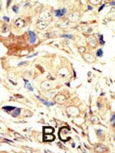 IHC-P - EGFR (ErbB1) Antibody (N-term) AP7628a