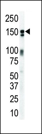 WB - ERBB3  Antibody (N-term) AP7630a