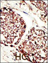 IHC-P - ERBB3  Antibody (N-term) AP7630a