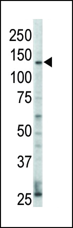 WB - ERBB4 Antibody(N-term) AP7631a