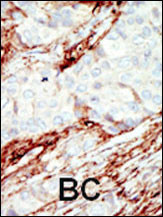 IHC-P - FGFR1 Antibody (N-term) AP7636a