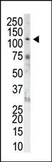 WB - FGFR1 Antibody (N-term) AP7636a
