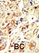 IHC-P - IGF1 Receptor (IGF1R) Antibody (N-term) AP7649a