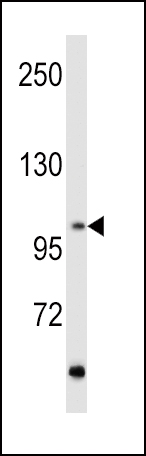 Western blot analysis of hRET-G28 (Cat. #AP7669c) in MCF7 cell line lysates (35ug/lane). RET (arrow) was detected using the purified Pab.