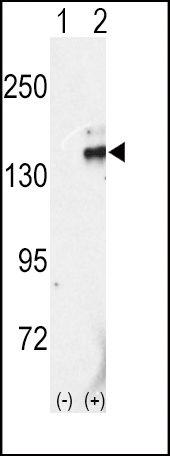 Western blot analysis of RET (arrow) using rabbit polyclonal RET Antibody (C-term L1027) (Cat.#AP7669d). 293 cell lysates (2 ug/lane) either nontransfected (Lane 1) or transiently transfected with the RET gene (Lane 2) (Origene Technologies).