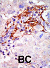 IHC-P - MEK3 (MAP2K3) Antibody (N-term) AP7915a