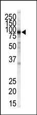 WB - IKK beta Antibody AM8109a