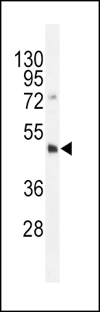 Dnmt3L-R322 (Cat. #AP1040a) western blot analysis in HL-60 cell line lysates (35ug/lane).This demonstrates the DNMT3L antibody detected the DNMT3L protein (arrow).