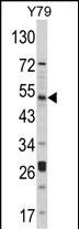 Western blot analysis of hAKT1-D453 (Cat. #AP7028b) in Y79 cell line lysates (35ug/lane).AKT1 (arrow) was detected using the purified Pab.