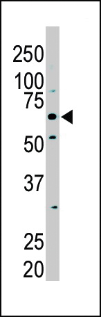 The anti-PKLR Pab (Cat. #AP7043a) is used in Western blot to detect PKLR in NIH/3T3 cell lysate.