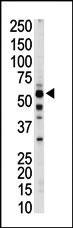 The anti-PKLR Pab (Cat. #AP7043b) is used in Western blot to detect PKLR in mouse liver tissue lysate.