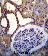 IHC-P - WNK3 (PRKWNK3) Antibody (C-term) AP7054b