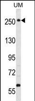 WB - WNK3 (PRKWNK3) Antibody (C-term) AP7054b