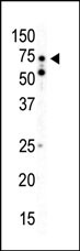 Western blot analysis of anti-AMPK alpha2 C-term Pab (Cat. #AP7203a) in mouse heart tissue lysate. AMPK alpha2 (arrow) was detected using purified Pab. Secondary HRP-anti-rabbit was used for signal visualization with chemiluminescence.