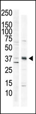 The anti-CAMK1 C-term Pab (Cat. #AP7205a) is used in Western blot to detect CAMK1 in HeLa cell lysate (lane 1) and primate brain tissue lysate (lane 2).