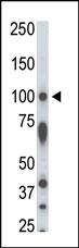 The anti-STK31 Pab (Cat. #AP7242a) is used in Western blot to detect STK31 in rat testis tissue lysate.