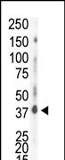 Western blot analysis of anti-CK1d C-term Pab (Cat. #AP7402a) in HeLa cell lysate. CK1d (arrow) was detected using purified Pab. Secondary HRP-anti-rabbit was used for signal visualization with chemiluminescence.