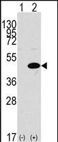 Western blot analysis of ERK1 (arrow) using rabbit ERK1 (N-term) Pab  (Cat. #AP7500a).293 cell lysates (2 ug/lane) either nontransfected (Lane 1) or transiently transfected with the MAPK1 gene (Lane 2) (Origene Technologies).