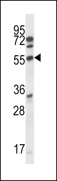 ALS2CR7 Antibody (R13) (Cat. #AP7512a) western blot analysis in A2058 cell line lysates (35ug/lane).This demonstrates the ALS2CR7 antibody detected the ALS2CR7 protein (arrow).