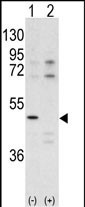 Western blot analysis of CDK10 antibody (N-term) (Cat. #AP7516a) pre-incubated with (Lane1) and without (Lane 2) blocking peptide (Cat. #BP7516a) in A375 cell line lysate. CDK10 (arrow) was detected using the purified Pab.