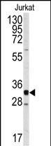 Western blot analysis of anti-CDK2 Antibody (C-term) (Cat.#AP7518b) in Jurkat cell line lysates (35ug/lane). CDK2 (arrow) was detected using the purified Pab.