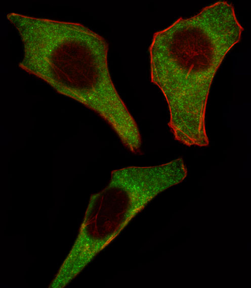 Fluorescent image of Hela cell stained with CDK4 Antibody (C-term)(Cat#AP7520b).Hela cells were fixed with 4% PFA (20 min), permeabilized with Triton X-100 (0.1%, 10 min), then incubated with CDK4 primary antibody (1:25, 1 h at 37?). For secondary antibody, Alexa Fluor� 488 conjugated donkey anti-rabbit antibody (green) was used (1:400, 50 min at 37?).Cytoplasmic actin was counterstained with Alexa Fluor� 555 (red) conjugated Phalloidin (7units/ml, 1 h at 37?).CDK4 immunoreactivity is localized to Cytoplasm significantly.