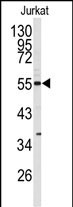 Western blot analysis of CDK8 antibody (N-term) (Cat.# AP7524a) in Jurkat cell line lysates (35ug/lane). CDK8 (arrow) was detected using the purified Pab.