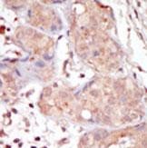 IHC-P - MAK Antibody (C-term) AP7542b