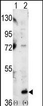 WB - MAPK14 Antibody (C-term) AP7546b