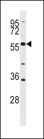 BLK Antibody (G1) (Cat. #AP7697a) western blot analysis in HL-60 cell line lysates (35ug/lane).This demonstrates the BLK antibody detected the BLK protein (arrow).