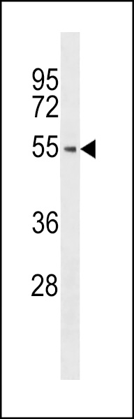 Western blot analysis of anti-hPTK6-E26 Pab (Cat. #AP7715a) in A375 cell line lysate (35ug/lane). hPTK6-E26(arrow) was detected using the purified Pab.