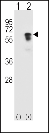 Western blot analysis of ACVR1 (arrow) using rabbit polyclonal ACVR1 Antibody (R147) (Cat.#AP7806c). 293 cell lysates (2 ug/lane) either nontransfected (Lane 1) or transiently transfected (Lane 2) with the ACVR1 gene.