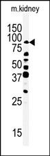 WB - RIPK4 (ANKRD3) Antibody (C-term) AP7808b