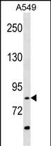 WB - RIPK4 (ANKRD3) Antibody (C-term) AP7808b