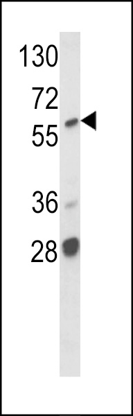 Western blot analysis of hARAF1-H270 (Cat. #AP7809c) in MCF7 cell line lysates (35ug/lane). ARAF1 (arrow) was detected using the purified Pab.