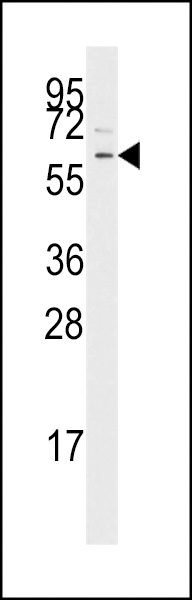 Western blot analysis of anti-TGFBR1 Pab (Cat. #AP7822c) in Jurkat cell line lysates (35ug/lane). TGFBR1 (arrow) was detected using the purified Pab.