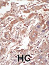 IHC-P - LOK Antibody (C-term E707) AP7959b
