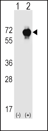 WB - SPAK Antibody (Center) AP7968c