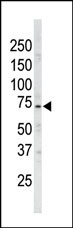 The anti-ARK5 Pab (Cat. #AP8066a) is used in Western blot to detect ARK5 in mouse brain tissue lysate.